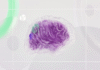 Canada has approved a drug that can slow the progression of Alzheimer’s disease