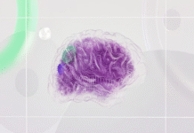 Canada has approved a drug that can slow the progression of Alzheimer’s disease